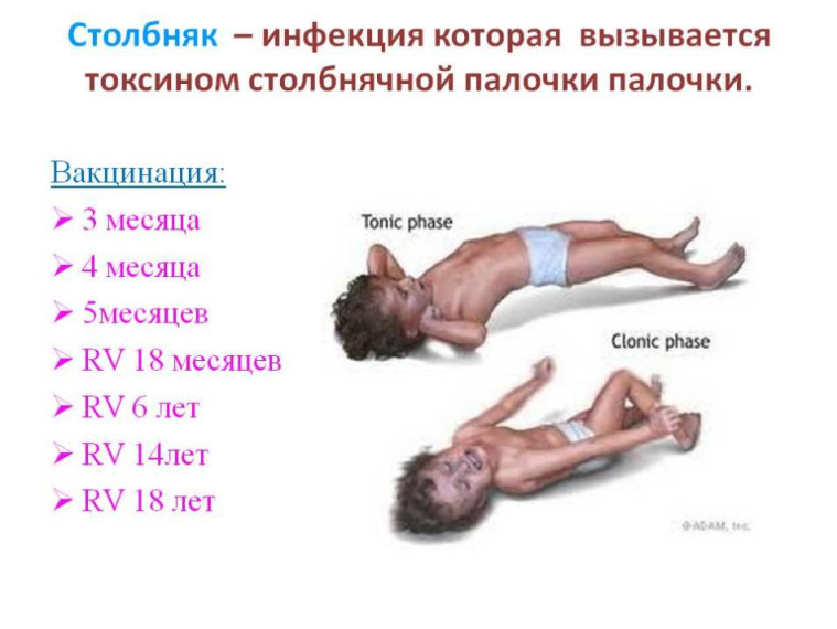 Защити себя от столбняка.